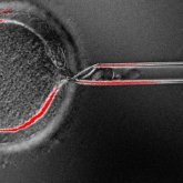 Clonan células madre embrionarias de personas